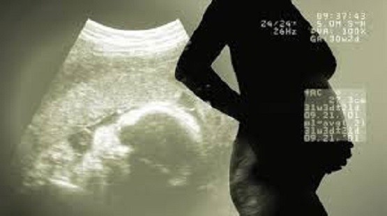 ultrasound3d22